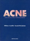 Acne Diagnosis and Management