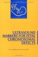 Ultrasound Markers for Fetal Chromosomal Defects (Charles Worthington Dream Hair Series)