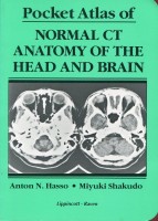 Pocket Atlas of Normal CT Anatomy of the Head and Brain